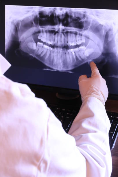 Best Knocked-Out Tooth Emergency  in Olney, IL